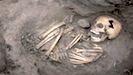 GiantSkeleton